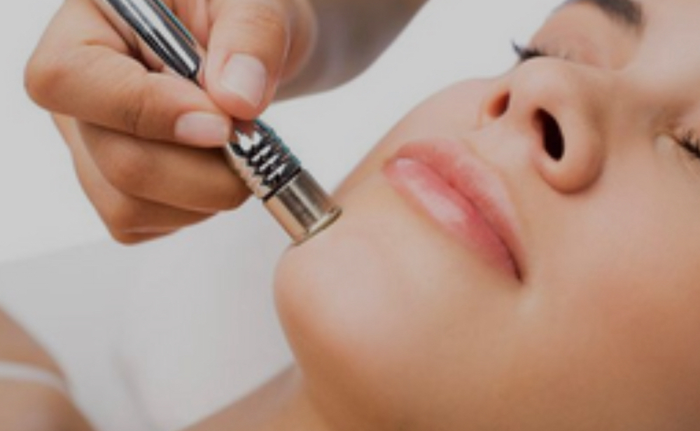 Microdermabrasion