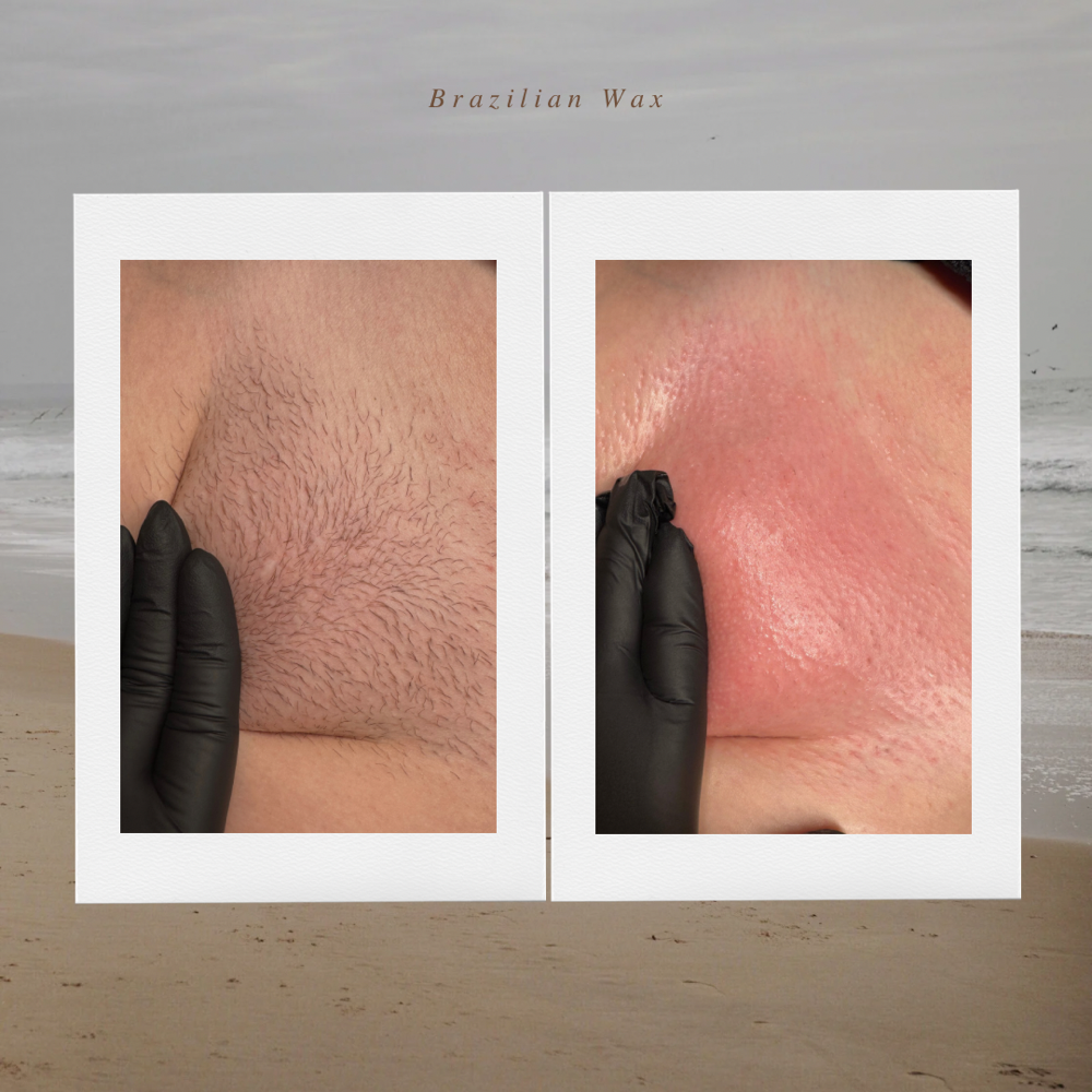 Intro Extended Brazilian Wax