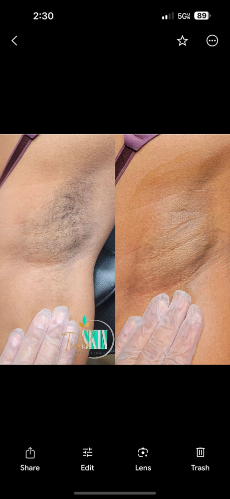 Underarm Wax