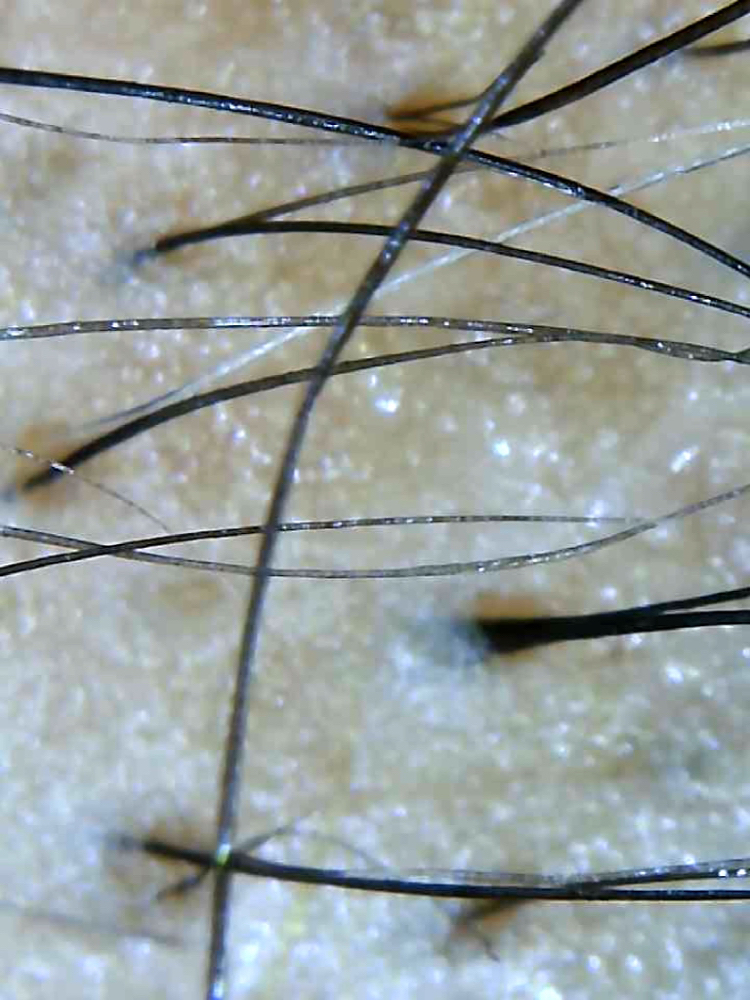 Hair and Scalp Analysis
