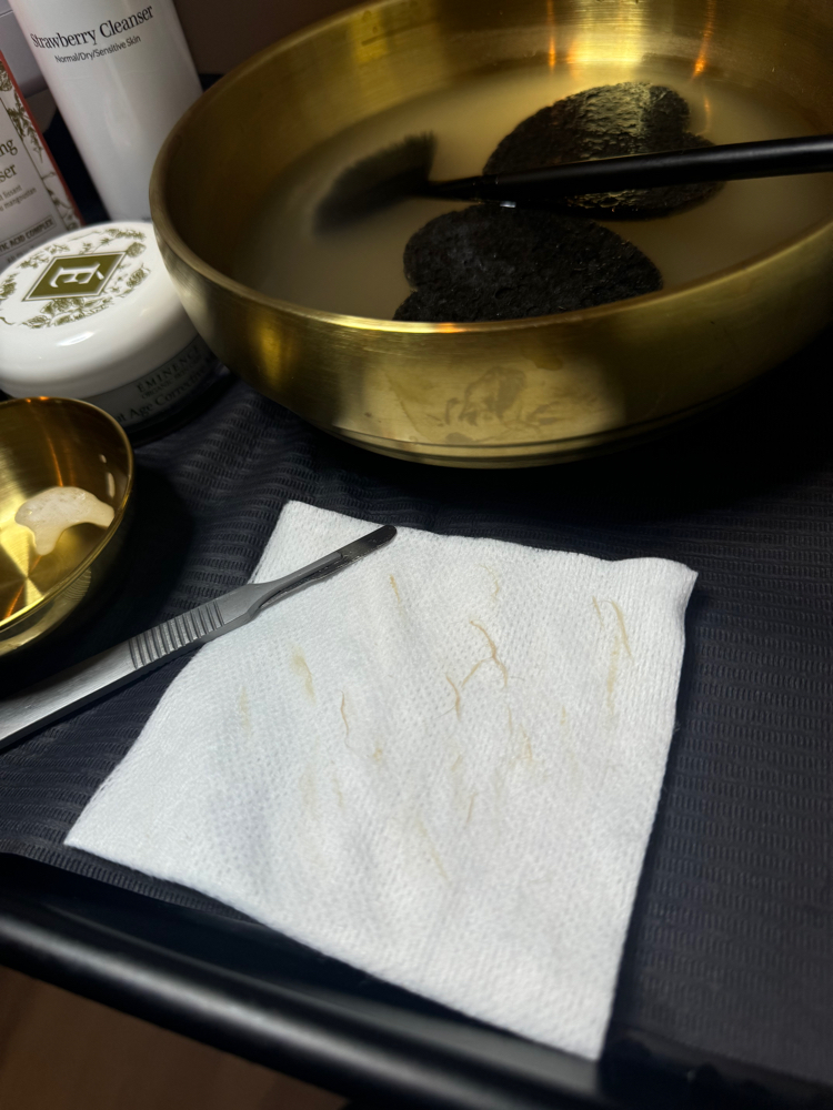Add On Dermaplaning
