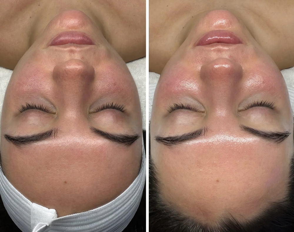 Signature Facial