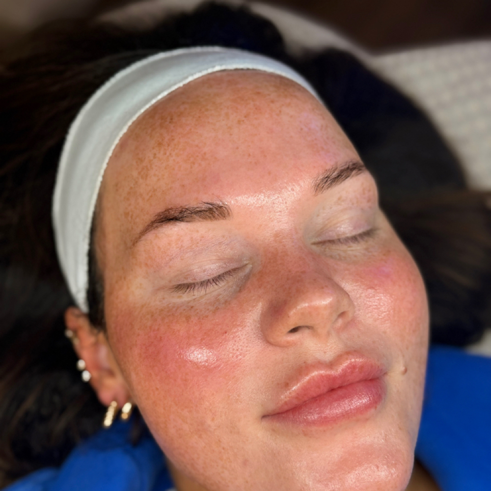Hydrafacial Signature at Kschaff aesthetics in Morristown, TN