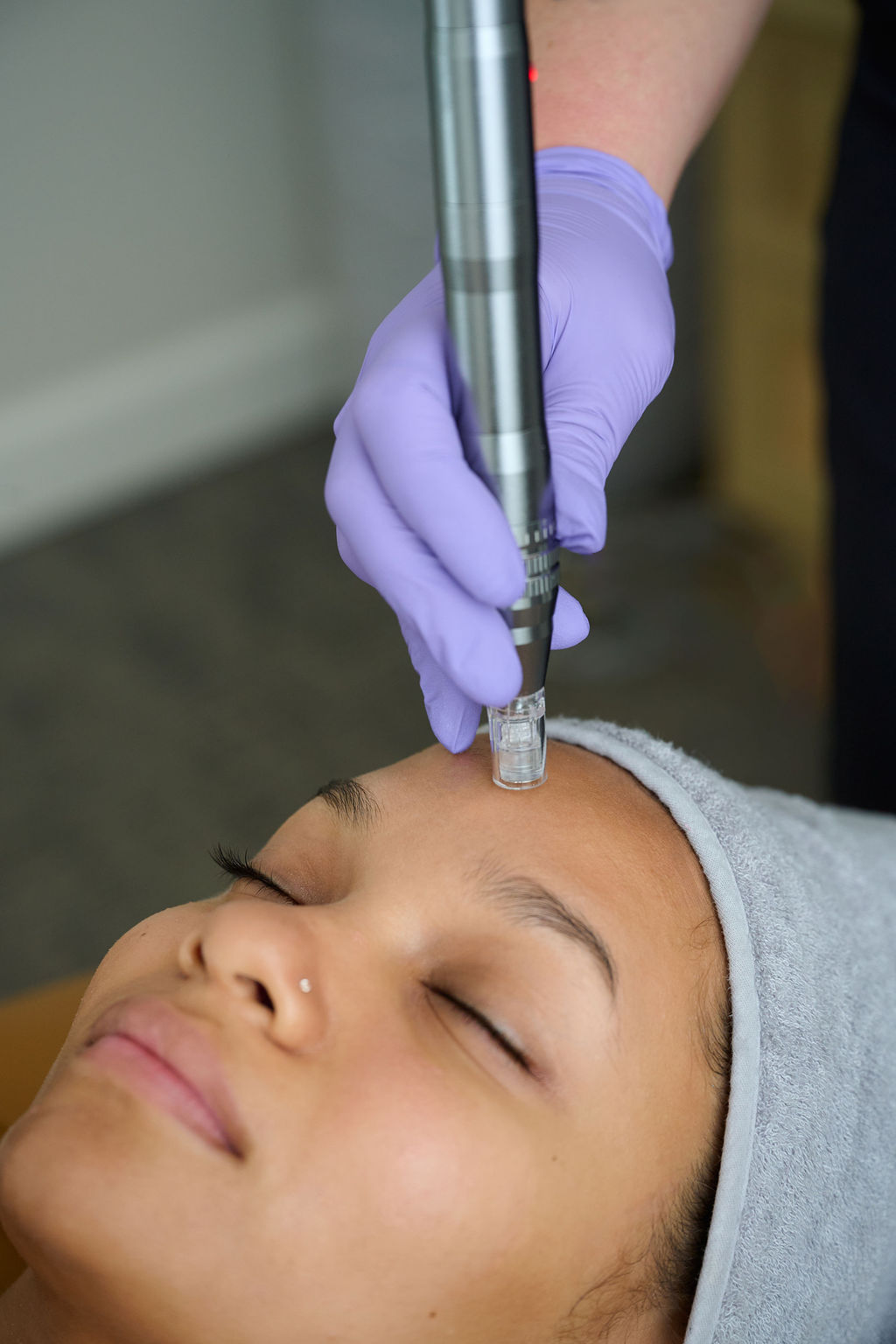 Skin Revision Treatment Sessions