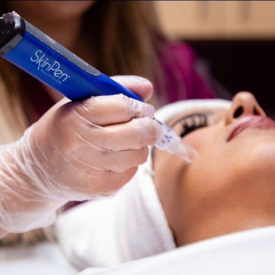 Add on - SkinPen PDRN Upgrade at BLUSH Aesthetics LLC in Laredo, TX