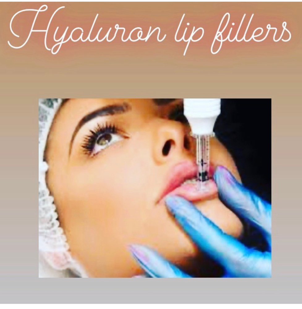 Filler