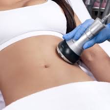 Cavitation Single Treatment