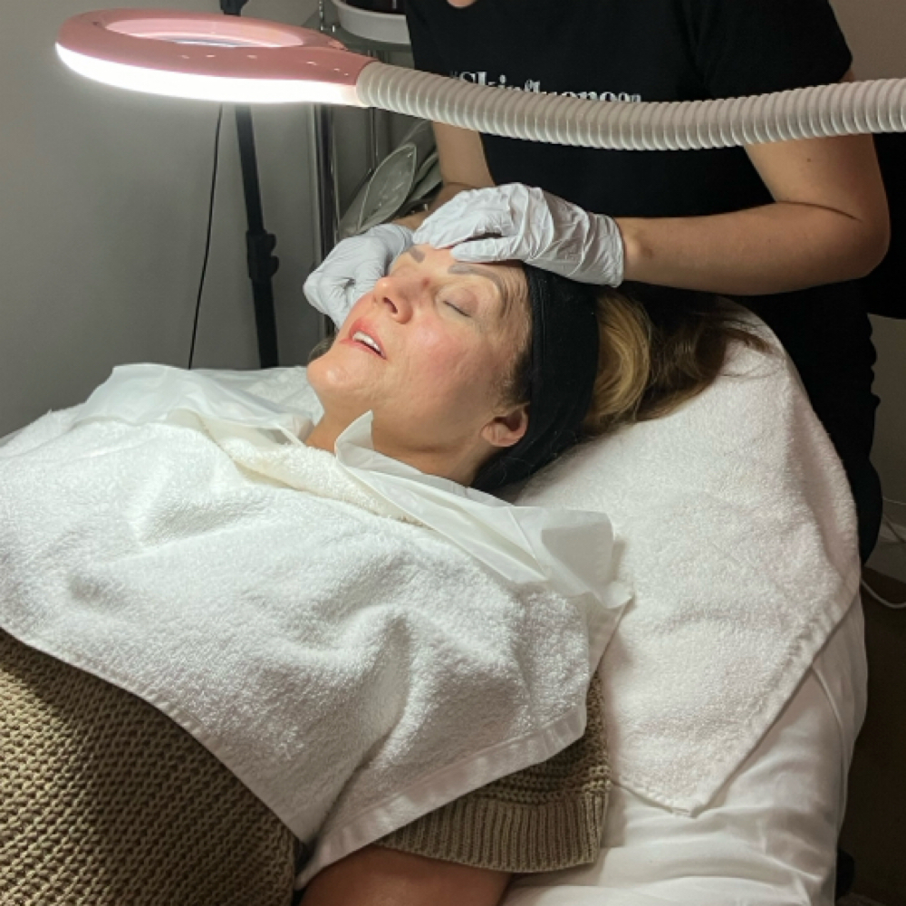 VI Medium Depth Chemical Peel at Southern Glow Skincare in Augusta, GA