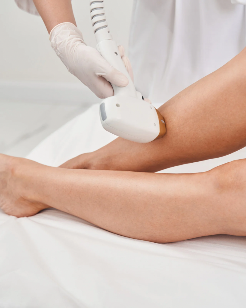 Half Legs Laser Hair Removal at M.A.V Aesthetics in Fort Morgan, CO