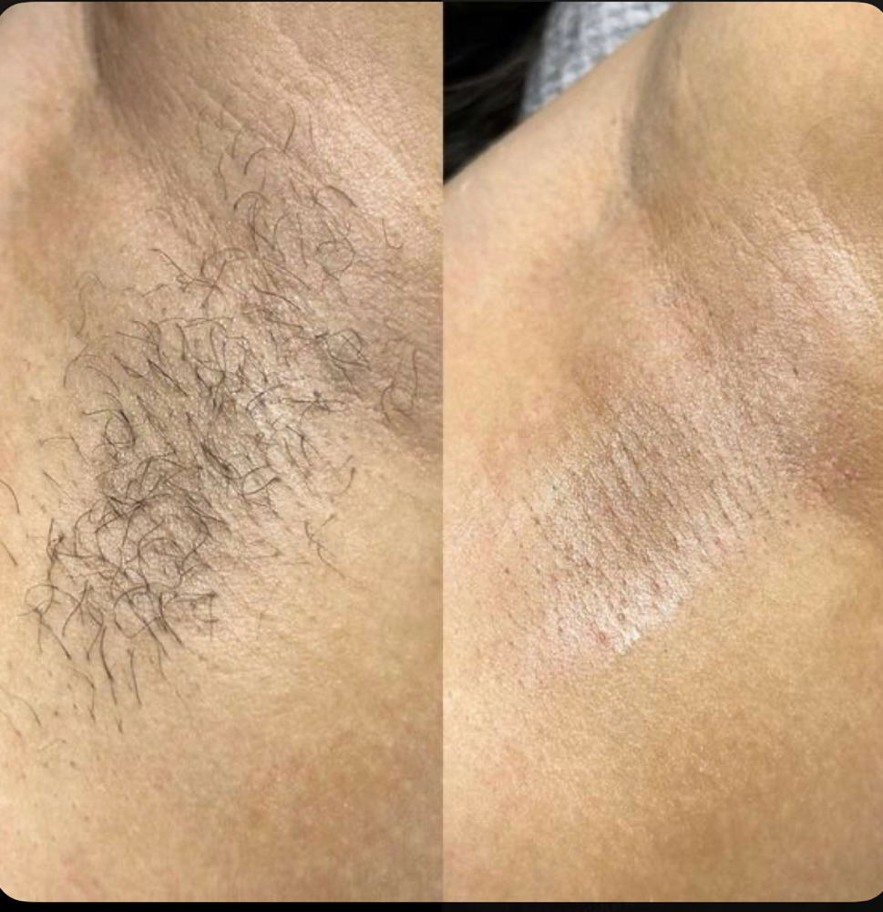 Underarm Wax