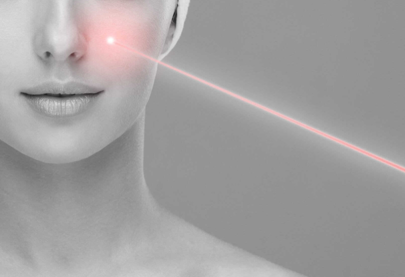 Lasers (IPL & RF Microneedling)