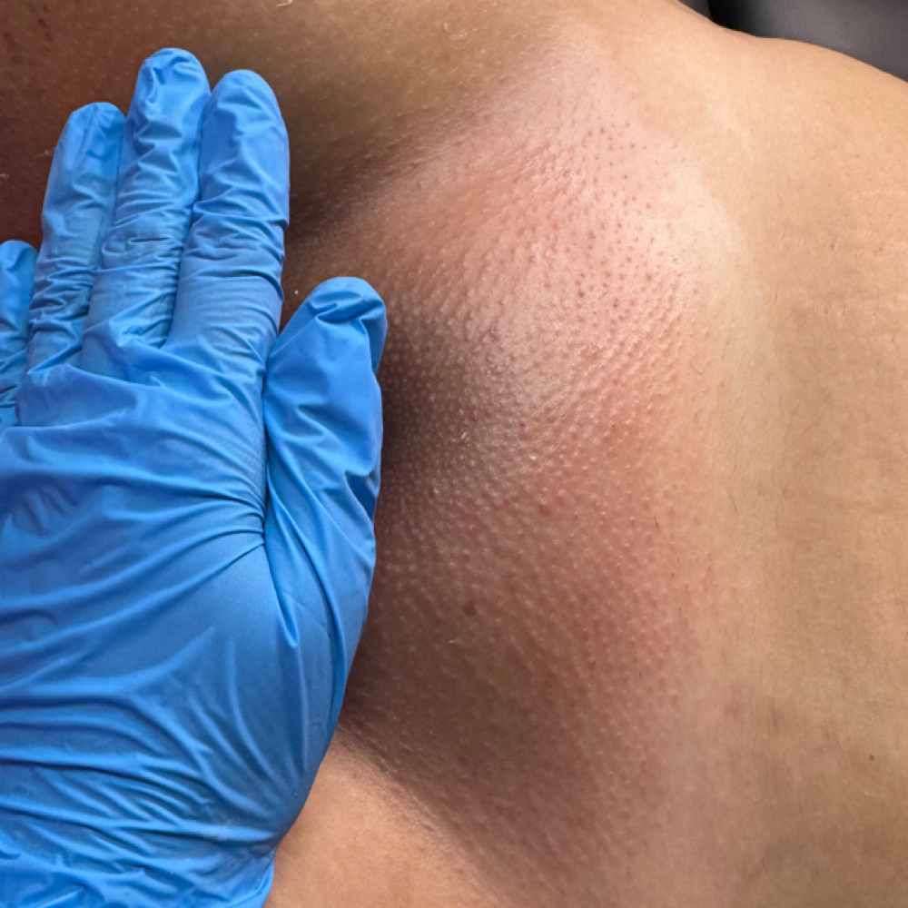 Brazilian Waxing at True Volume studio in North Hills, CA
