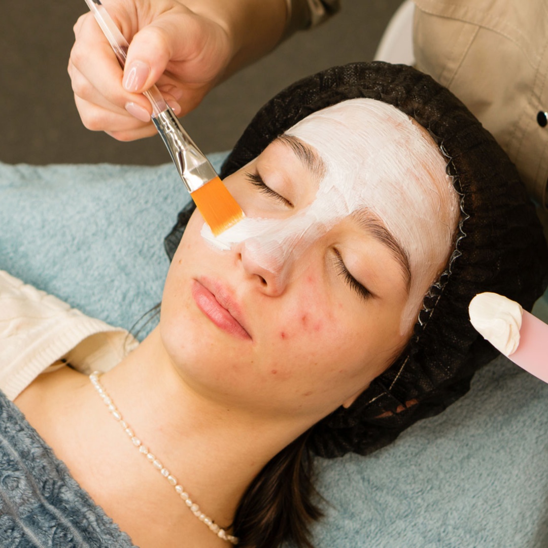 Acne Facial at Willow Wellness Spa in Indianapolis, IN