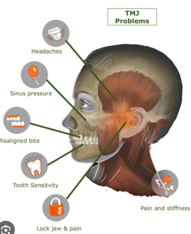 TMJ/ Myofascial release (MFR)