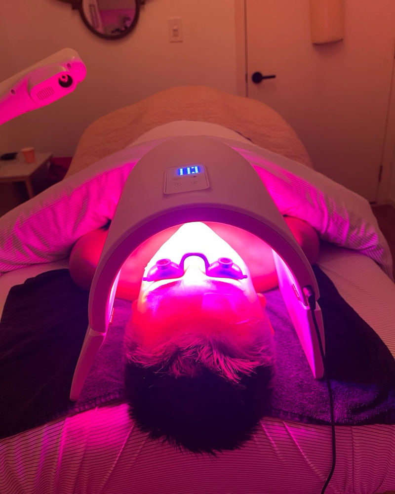 Acne Treatment With Blue Light