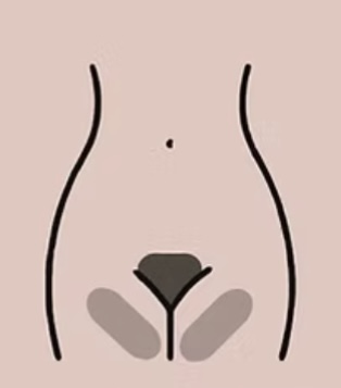 Inner Thigh Treatment