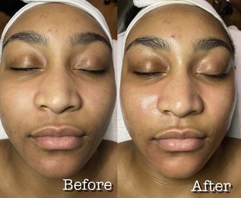 Customized Facial