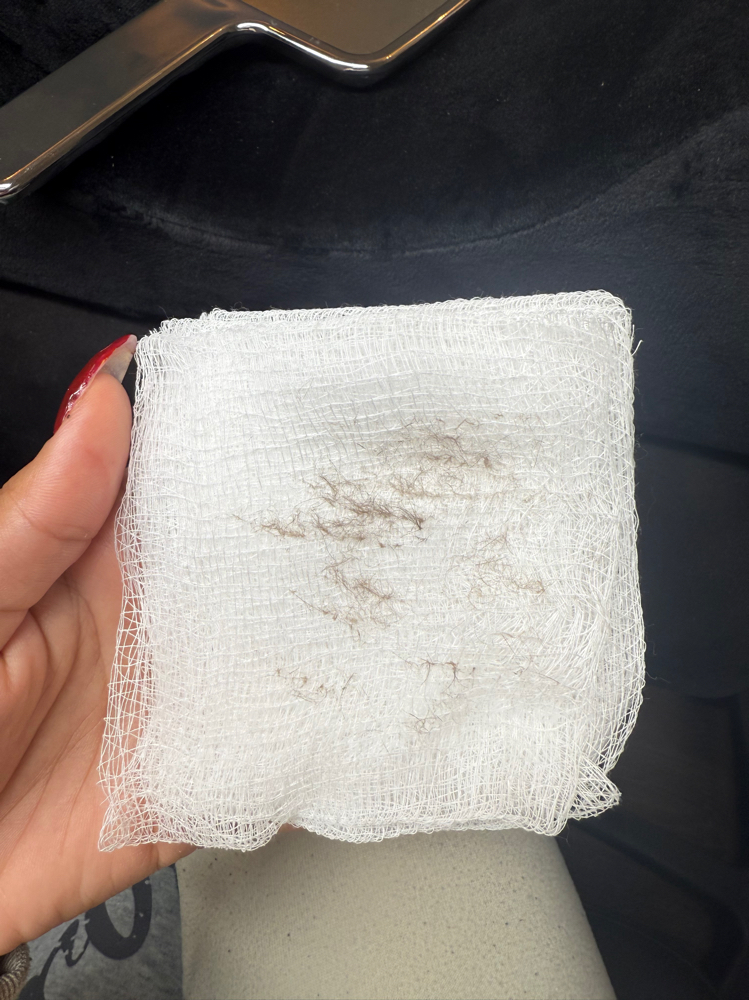 Dermaplane Facial at Sundarabeauty in North Canton, OH