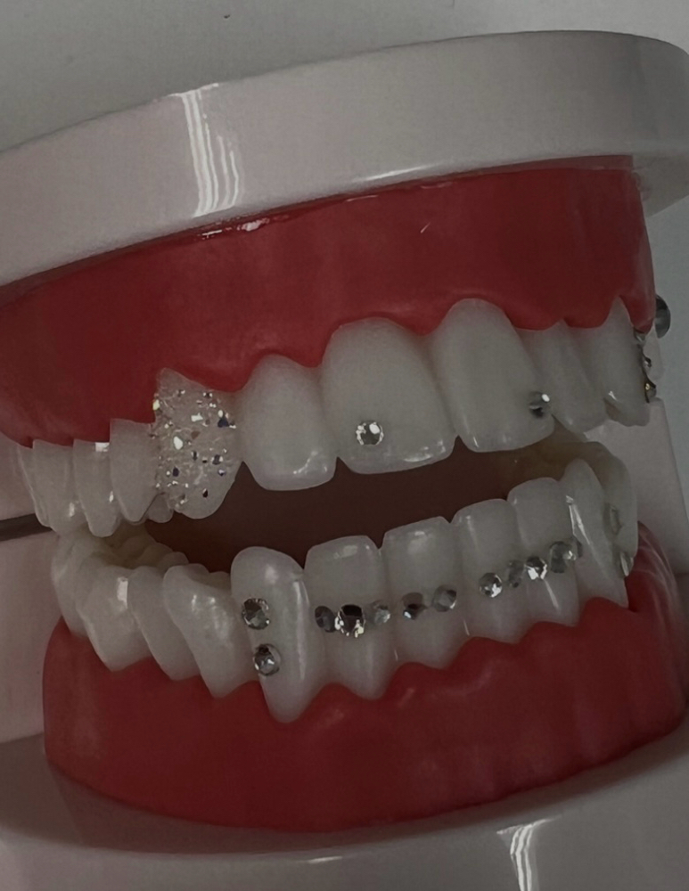 30-day Replacement Tooth Gem