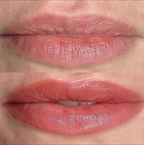 Microneedling Lip Blushing