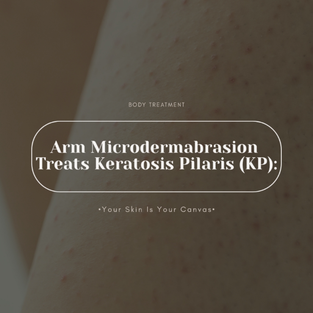 Arm Microdermabrasion at Face Palette Aesthetics in Franklin, WI