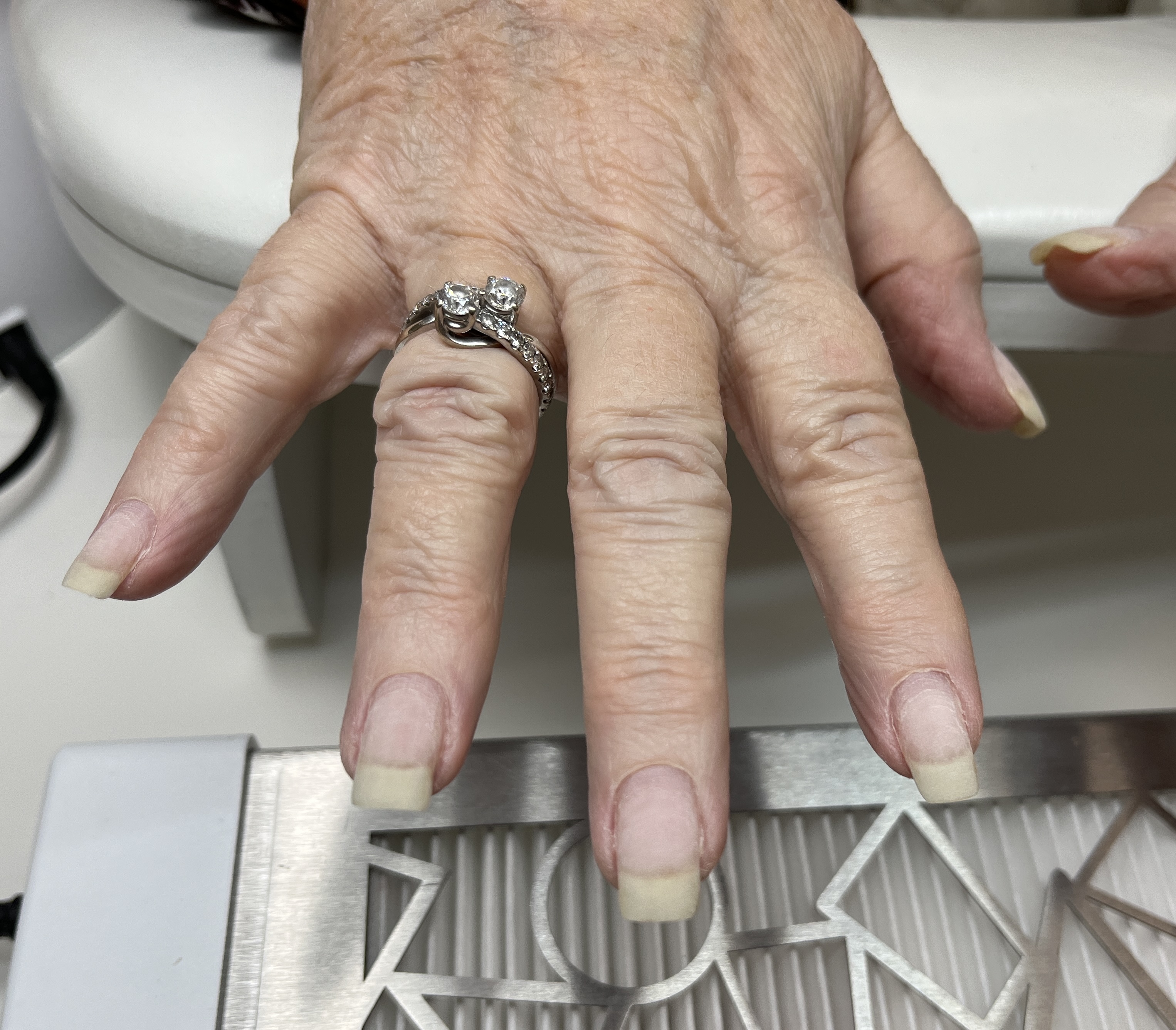 Artificial Nail Removal