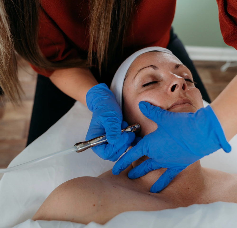 Microdermabrasion Facial