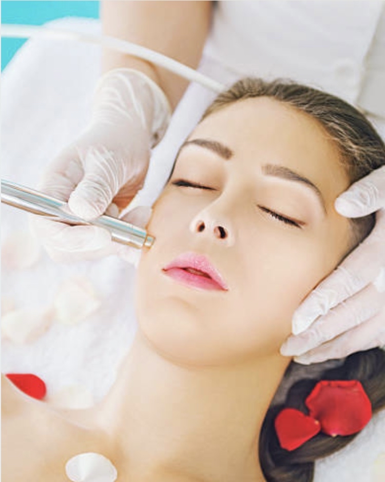 Microdermabrasion Facial