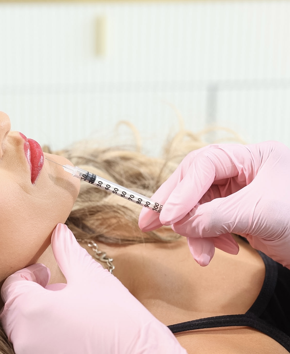 LIP ENHANCEMENT-HALF SYRINGE