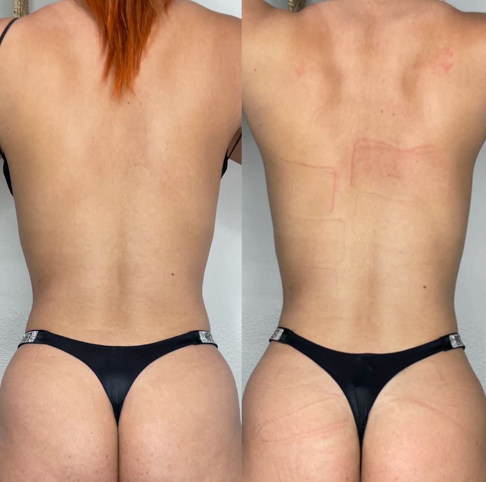 Back Contour Session