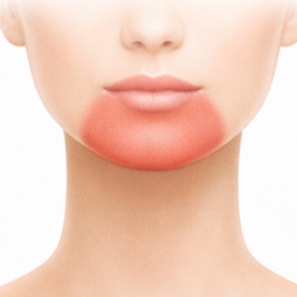 Chin at Mizpacio Body & Beauty studio in Hidalgo, TX
