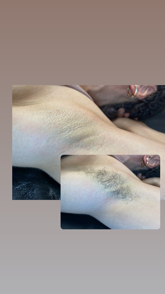 Underarm Wax