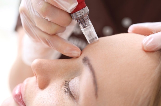 Micro-Needling W/ Age-Zero Exosome