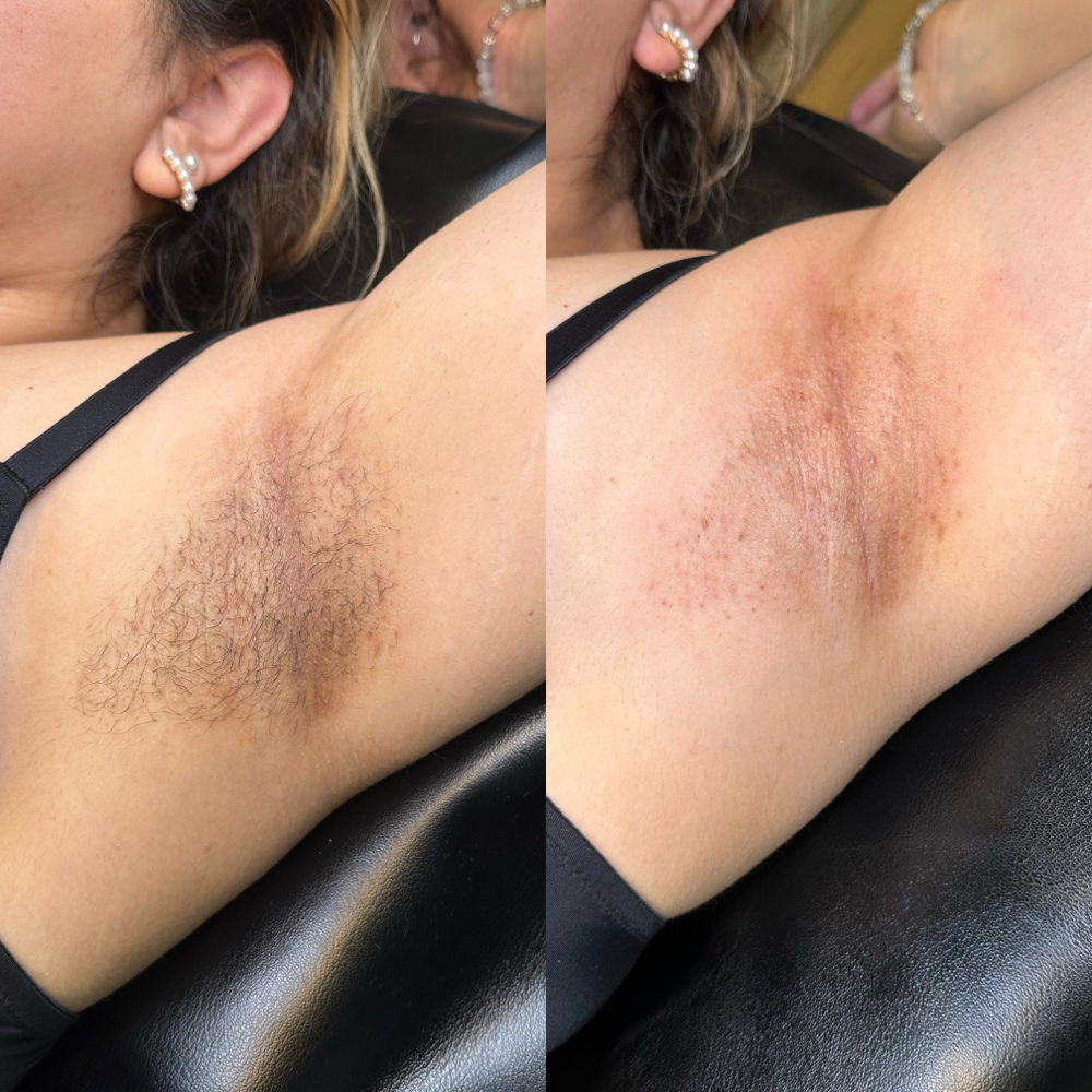 UNDERARMS
