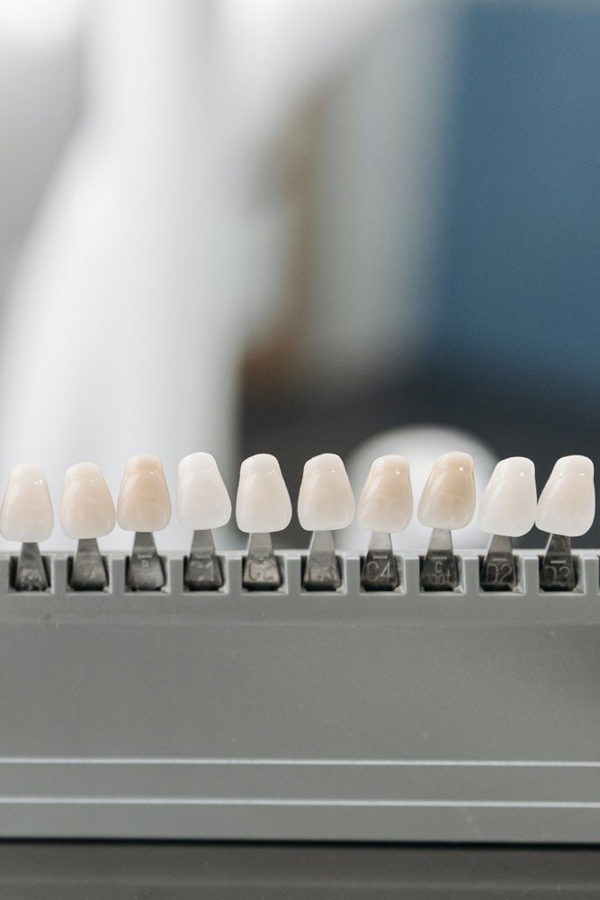 Teeth Whitneing 10 Minute Add On