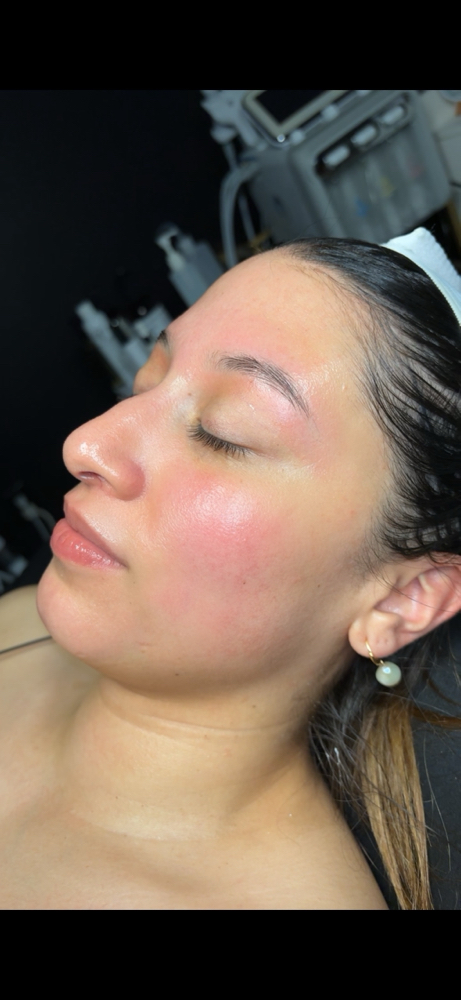 TBM Forever Young Facial