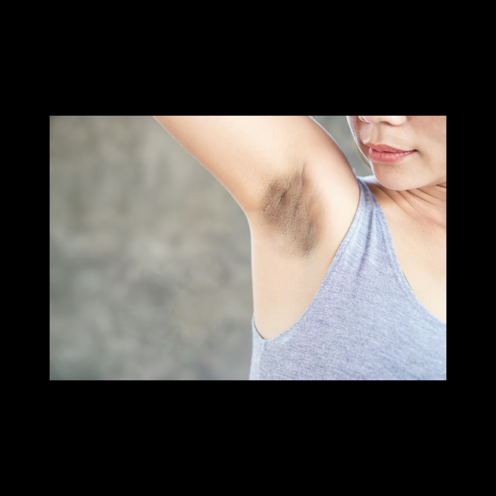 Underarm Brightening