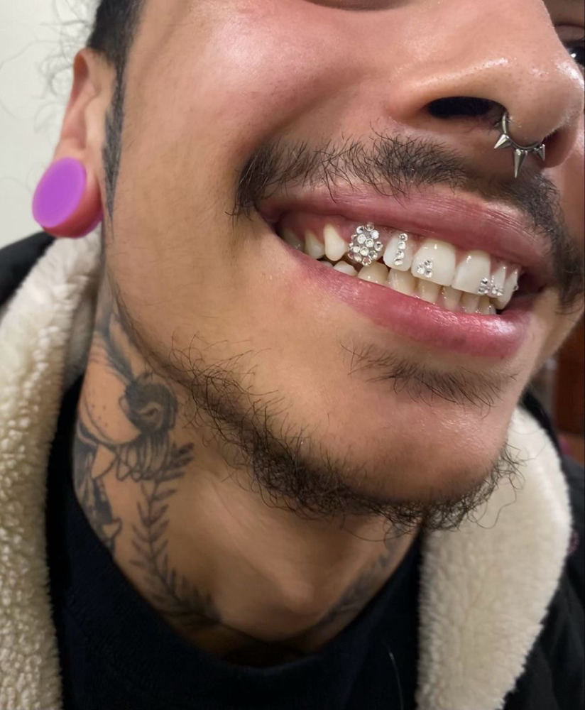 Disco Tooth