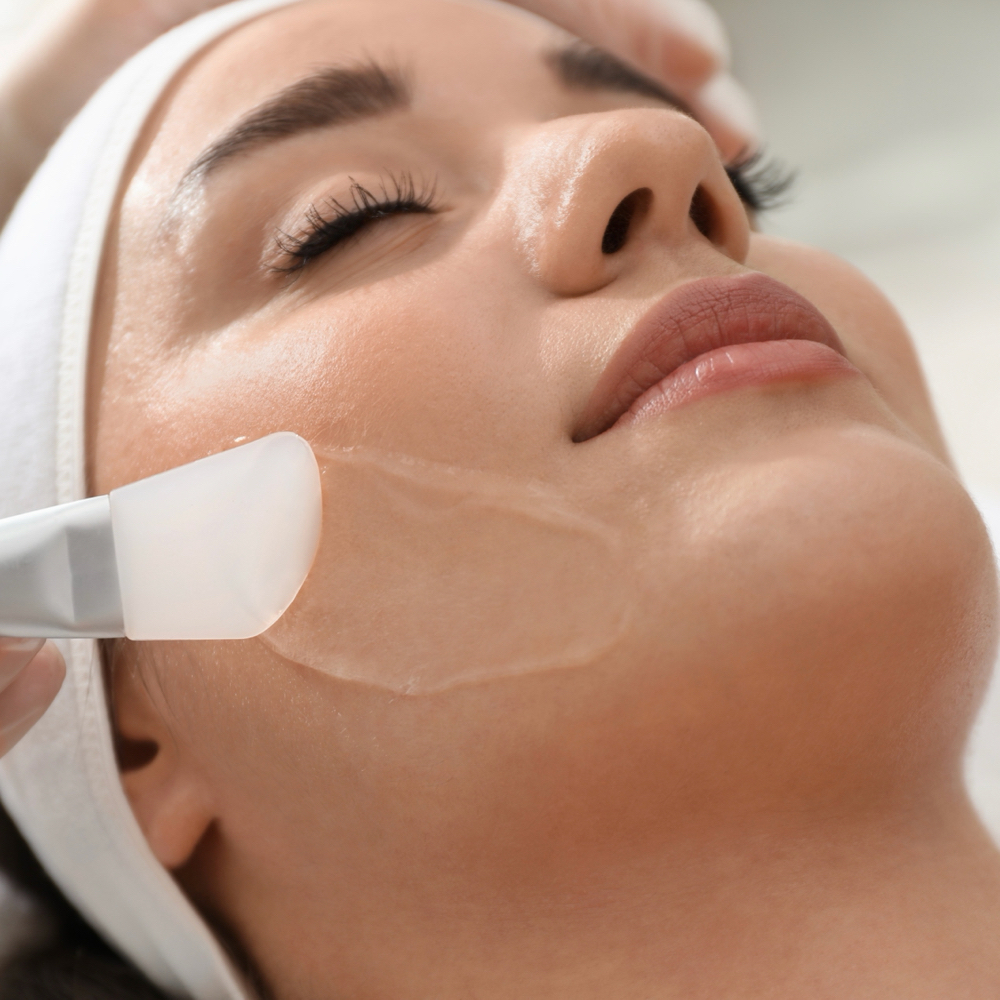 Chemical Peel