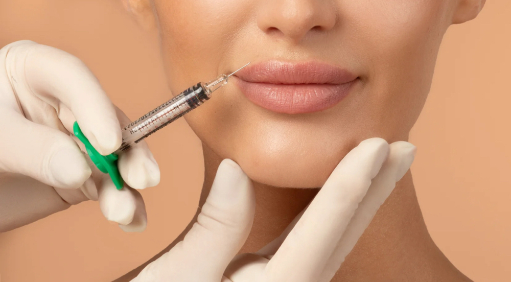Hyaluronic Acid Filler