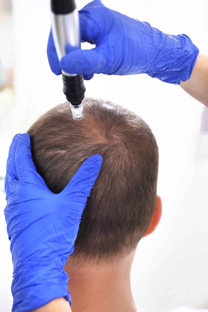 Tratamiento Crecimiento de Cabello
