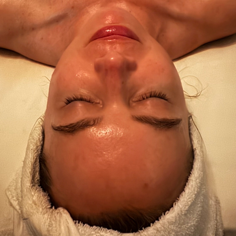 Advanced Glow Treatments at Hello Glow Esthetics in Plantation, FL
