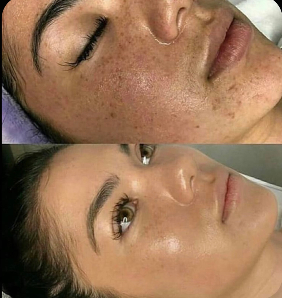 BB Glow (permanent foundation)