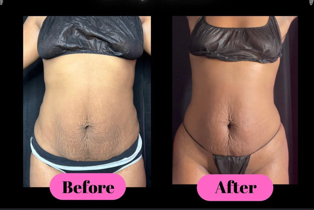 WaistLine Snatched 360 at Royal Glow Experience LLC in Houston, TX