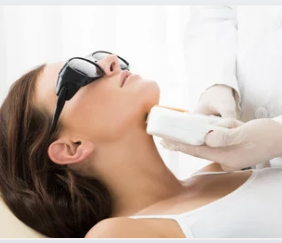 Acne/Cystic Acne Laser Treatment