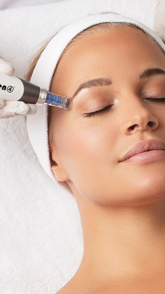 Microneedling