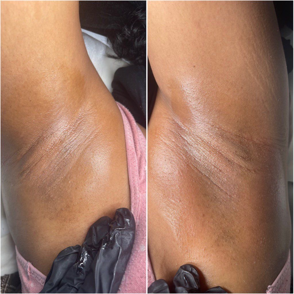 Underarm waxing