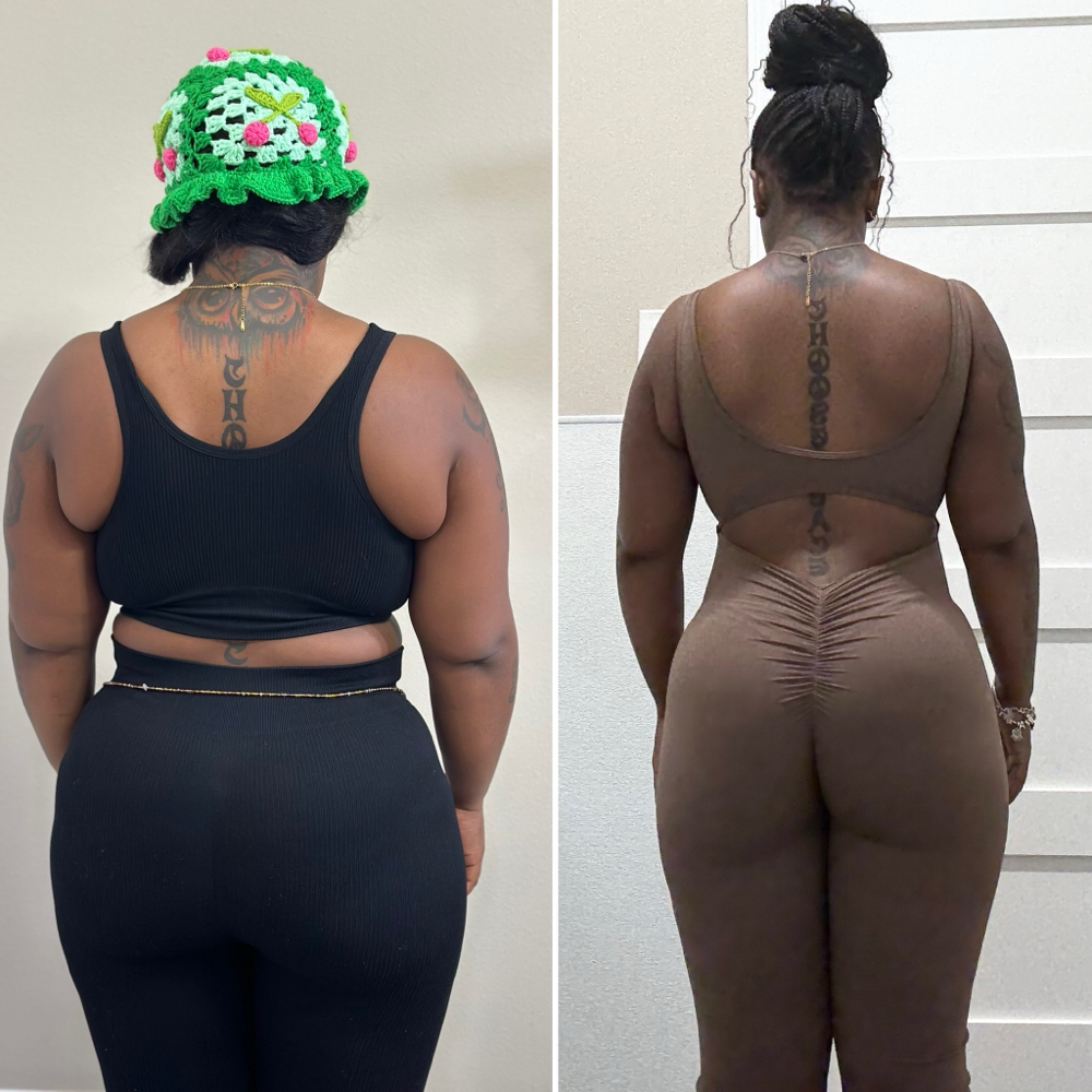 Weight Loss💉GLP1