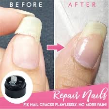 Nail Fix
