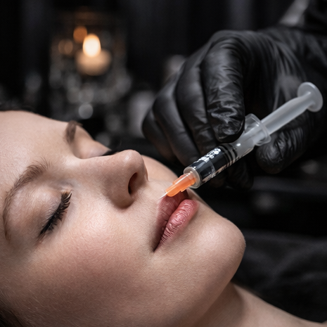 Dermal Filler at Black Lace & Pretty Face Aesthetics in Temecula, CA